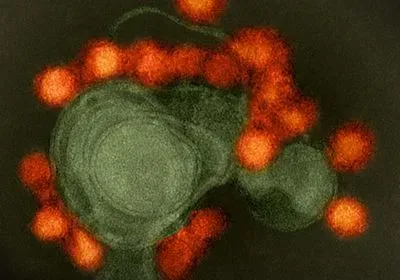 Transmission electron microscope image of Zika virus particles Transmission electron microscope image of Zika virus particles